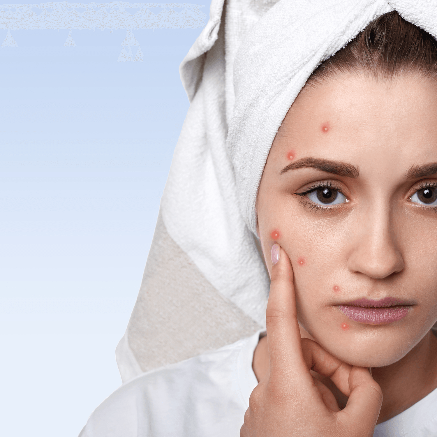 Acne Skin Positivity Portrait